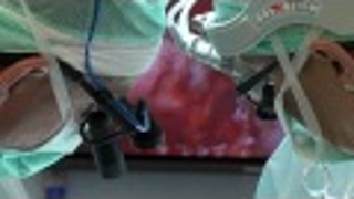 Swedish Doctors Have Pulled Off Womb Transplants for 9 Women